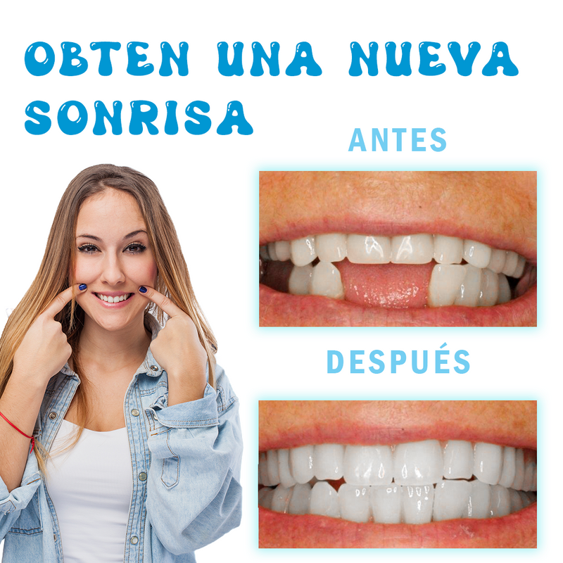 Resina Moldeable Dientes