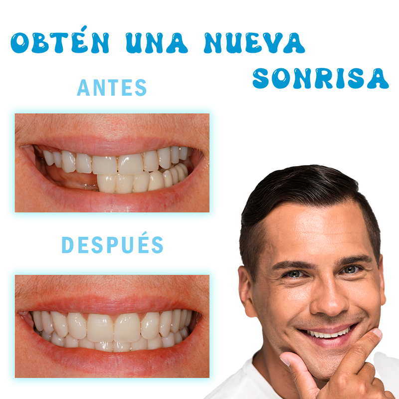 Resina Moldeable Dientes